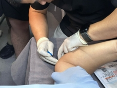 针刀培训班哪好